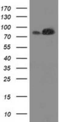 Western Blot: STRIP1 Antibody (OTI7B8) [NBP2-45715] - Analysis of HEK293T cells were transfected with the pCMV6-ENTRY control (Left lane) or pCMV6-ENTRY STRIP1.