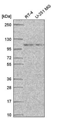 Western Blot: STRIP1 Antibody [NBP2-56570] - Analysis in human cell line RT-4 and human cell line U-251 MG.