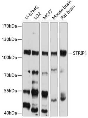 Western Blot: STRIP1 Antibody [NBP2-93448] - Analysis of extracts of various cell lines, using STRIP1 at 1:1000 dilution. Secondary antibody: HRP Goat Anti-Rabbit IgG (H+L) at 1:10000 dilution. Lysates/proteins: 25ug per lane. Blocking buffer: 3% nonfat dry milk in TBST. Detection: ECL Basic Kit . Exposure time: 20s.