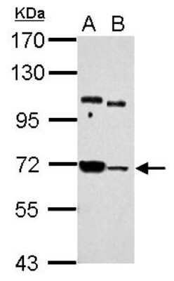 Western Blot: UBASH3B/STS1/Tula-2 Antibody [NBP2-20523] -  Sample (30 ug of whole cell lysate) A: Jurkat B: THP-1 7. 5% SDS PAGE gel, diluted at 1:5000.