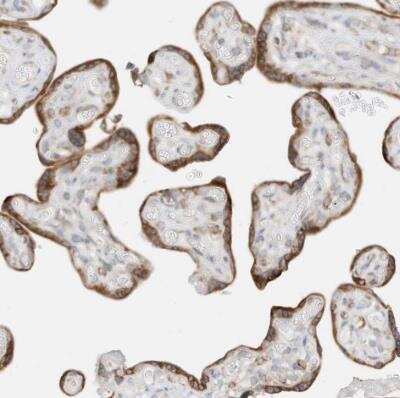 Immunohistochemistry-Paraffin STT3A Antibody