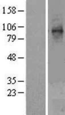 Western Blot: STT3A Overexpression Lysate (Adult Normal) [NBL1-16572] Left-Empty vector transfected control cell lysate (HEK293 cell lysate); Right -Over-expression Lysate for STT3A.