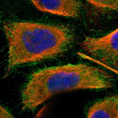 Immunocytochemistry/Immunofluorescence: STX18 Antibody [NBP1-80645] - Saining of human cell line A-431 shows localization to plasma membrane. Antibody staining is shown in green. 