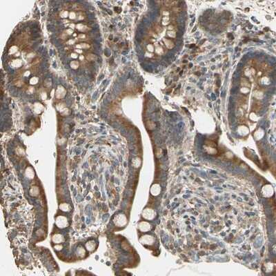 Immunohistochemistry-Paraffin: STX18 Antibody [NBP1-80645] - Staining of human colon shows cytoplasmic positivity in glandular cells.