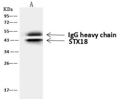 Immunoprecipitation: STX18 Antibody [NBP2-98545] - Lane A:0.5 mg 293T Whole Cell Lysate4 uL anti-STX18 rabbit polyclonal antibody and 60 ug of Immunomagnetic beads Protein A/G.Primary antibody:Anti-STX18 rabbit polyclonal antibody,at 1:100 dilutionSecondary antibody:Goat Anti-Rabbit IgG (H+L)/HRP at 1/10000 dilutionDeveloped using the ECL technique.Performed under reducing conditions.Predicted band size: 39 kDaObserved band size :43 kDa