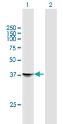 Western Blot: STX18 Antibody [H00053407-B01P] - Analysis of STX18 expression in transfected 293T cell line by STX18 polyclonal antibody.  Lane 1: STX18 transfected lysate(36.85 KDa). Lane 2: Non-transfected lysate.