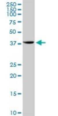 Western Blot: STX18 Antibody [H00053407-D01P] - Analysis of STX18 expression in HeLa.