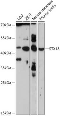 Western Blot: STX18 Antibody [NBP2-93340] - Analysis of extracts of various cell lines, using STX18 . Exposure time: 90s.