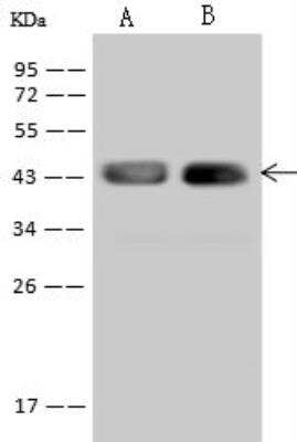 Western Blot: STX18 Antibody [NBP2-98545] - Lane A: 293T Whole Cell LysateLane B: HeLa Whole Cell LysateLysates/proteins at 30 ug per lane.SecondaryGoat Anti-Rabbit IgG (H+L)/HRP at 1/10000 dilution.Developed using the ECL technique.Performed under reducing conditions.Predicted band size:39 kDaObserved band size:43 kDa