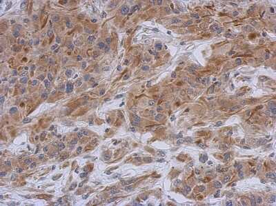 Immunohistochemistry-Paraffin: Syntaxin-BP1 Antibody [NBP2-20525] - U373 xenograft, using STXBP1 antibody at 1:500 dilution. Antigen Retrieval: Trilogy™ (EDTA based, pH 8.0) buffer, 15min.