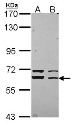 Western Blot: STXBP1 Antibody [NBP2-20526] - Sample (30 ug of whole cell lysate) A: 293T B: A431 7. 5% SDS PAGE gel, diluted at 1:3000.