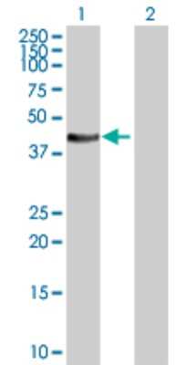 Western Blot: STYK1 Antibody [H00055359-D01P] - Analysis of STYK1 expression in transfected 293T cell line by STYK1 polyclonal antibody.Lane 1: STYK1 transfected lysate(47.50 KDa).Lane 2: Non-transfected lysate.