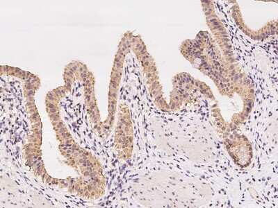 Immunohistochemistry-Paraffin: STYX Antibody [NBP2-97319] - Immunochemical staining of human STYX in human gallbladder with rabbit polyclonal antibody at 1:100 dilution, formalin-fixed paraffin embedded sections.