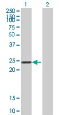 Western Blot: STYX Antibody [H00006815-B01P] - Analysis of STYX expression in transfected 293T cell line by STYX polyclonal antibody.  Lane 1: STYX transfected lysate(24.53 KDa). Lane 2: Non-transfected lysate.