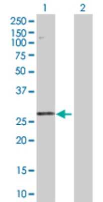 Western Blot: STYX Antibody [H00006815-D01P] - Analysis of STYX expression in transfected 293T cell line by STYX polyclonal antibody.Lane 1: STYX transfected lysate(25.50 KDa).Lane 2: Non-transfected lysate.