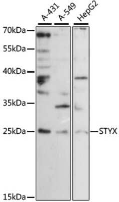 Western Blot: STYX Antibody [NBP2-94664] - Analysis of extracts of various cell lines, using STYX at 1:1000 dilution. Secondary antibody: HRP Goat Anti-Rabbit IgG (H+L) at 1:10000 dilution. Lysates/proteins: 25ug per lane. Blocking buffer: 3% nonfat dry milk in TBST. Detection: ECL Basic Kit . Exposure time: 180s.