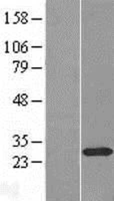 Western Blot: STYX Overexpression Lysate (Adult Normal) [NBP2-09519] Left-Empty vector transfected control cell lysate (HEK293 cell lysate); Right -Over-expression Lysate for STYX.