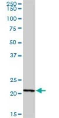 Western Blot: STYXL1 Antibody [H00051657-B02P] - Analysis of STYXL1 expression in human colon.