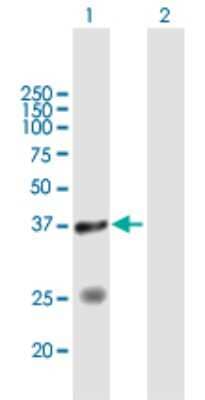 Western Blot: STYXL1 Antibody [H00051657-B02P] - Analysis of STYXL1 expression in transfected 293T cell line by STYXL1 polyclonal antibody.  Lane 1: STYXL1 transfected lysate(34.43 KDa). Lane 2: Non-transfected lysate.