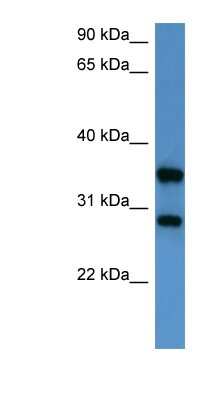 Western Blot: STYXL1 Antibody [NBP1-79814] - HepG2 cell lysate, concentration 0.2-1 ug/ml.