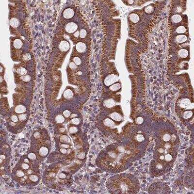 Immunohistochemistry: SUCLA2 Antibody [NBP2-56491] - Immunohistochemical staining of human small intestine shows strong cytoplasmic positivity in glandular cells.