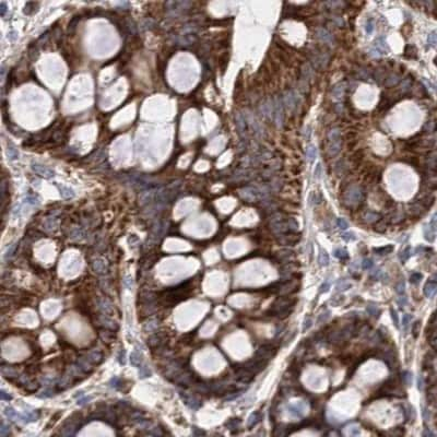 Immunohistochemistry-Paraffin: SUCLA2 Antibody [NBP1-85860] - Staining of human colon.