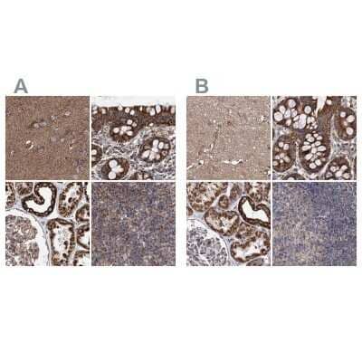 Immunohistochemistry-Paraffin SUCLA2 Antibody