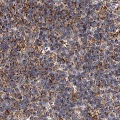 Immunohistochemistry-Paraffin: SUCLA2 Antibody [NBP2-55488] - Staining of human lymph node.