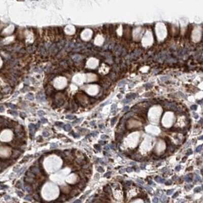 Immunohistochemistry-Paraffin: SUCLA2 Antibody [NBP2-55488] - Staining of human colon.