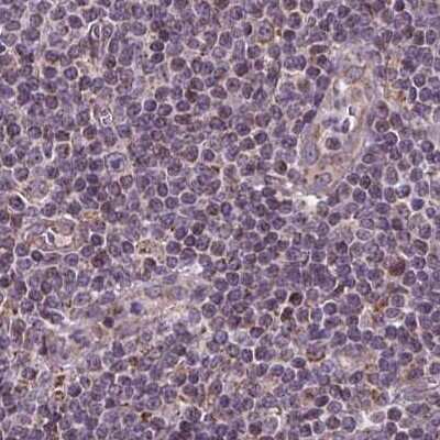 Immunohistochemistry-Paraffin: SUCLA2 Antibody [NBP2-56491] - Staining of human lymph node.