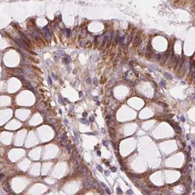 Immunohistochemistry-Paraffin: SUCLA2 Antibody [NBP2-56491] - Staining of human colon.