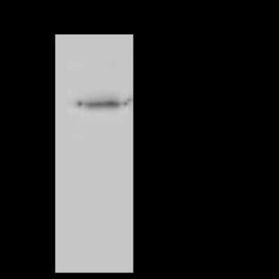 Immunoprecipitation: SUCLA2 Antibody [NBP2-97755] - SUCLA2 was immunoprecipitated using: Lane A: 0.5 mg Mouse kidney Whole Cell Lysate 4 ul anti-SUCLA2 rabbit polyclonal antibody and 60 ug of Immunomagnetic beads Protein A/G.  Primary antibody: Anti-SUCLA2 rabbit polyclonal antibody, at 1:100 dilution. Secondary antibody: Clean-Blot IP Detection Reagent (HRP) at 1:1000dilution. Developed using the ECL technique. Performed under reducing conditions. Predicted band size: 50 kDa. Observed band size: 50 kDa