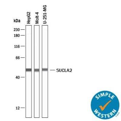 Simple Western: SUCLA2 Antibody [NBP1-85860] - Simple Western Lane view shows HepG2, Molt-4, U-251-MG whole cell lysate (WCL). A specific band was detected for SUCLA2 antibody (NBP1-85860) at approximately 50 kDa (as indicated) using 25 ug/mL of SUCLA2 antibody. This experiment was conducted under reducing conditions.