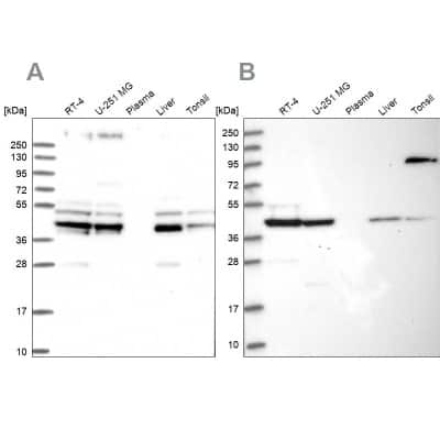 Western Blot: SUCLA2 Antibody [NBP1-85860] - Analysis using Anti-SUCLA2 antibody NBP1-85860 (A) shows similar pattern to independent antibody NBP2-55488 (B).