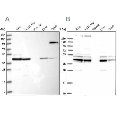 Western Blot: SUCLA2 Antibody [NBP2-55488] - Analysis using Anti-SUCLA2 antibody NBP2-55488 (A) shows similar pattern to independent antibody NBP1-85860 (B).