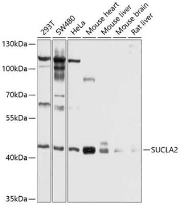 Western Blot: SUCLA2 Antibody [NBP2-94539] - Analysis of extracts of various cell lines, using SUCLA2 at 1:1000 dilution. Secondary antibody: HRP Goat Anti-Rabbit IgG (H+L) at 1:10000 dilution. Lysates/proteins: 25ug per lane. Blocking buffer: 3% nonfat dry milk in TBST. Detection: ECL Basic Kit . Exposure time: 1s.