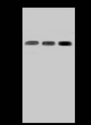 Western Blot: SUCLA2 Antibody [NBP2-97755] - Anti-SUCLA2 rabbit polyclonal antibody at 1:500 dilution. Lane A: HepG2 Whole Cell Lysate Lane B: MOLT-4 Whole Cell Lysate Lane C: U-251 MG Whole Cell Lysate Lysates/proteins at 30 ug per lane. Secondary Goat Anti-Rabbit IgG (H+L)/HRP at 1/10000 dilution. Developed using the ECL technique. Performed under reducing conditions. Predicted band size: 50 kDa. Observed band size: 45 kDa