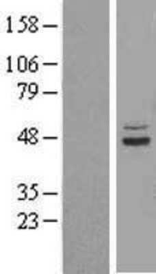 Western Blot: SUCLA2 Overexpression Lysate (Adult Normal) [NBL1-16594] Left-Empty vector transfected control cell lysate (HEK293 cell lysate); Right -Over-expression Lysate for SUCLA2.