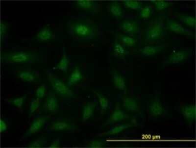 Immunocytochemistry/Immunofluorescence: SUGT1 Antibody (6G5) [H00010910-M03] - Analysis of monoclonal antibody to SUGT1 on HeLa cell. Antibody concentration 10 ug/ml