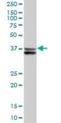 Western Blot: SUGT1 Antibody [H00010910-B01P] - Analysis of SUGT1 expression in human pancreas.