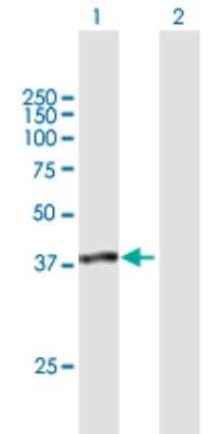 Western Blot: SUGT1 Antibody [H00010910-B01P] - Analysis of SUGT1 expression in transfected 293T cell line by SUGT1 polyclonal antibody.  Lane 1: SUGT1 transfected lysate(36.63 KDa). Lane 2: Non-transfected lysate.