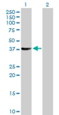Western Blot: SUGT1 Antibody [H00010910-D01P] - Analysis of SUGT1 expression in transfected 293T cell line by SUGT1 polyclonal antibody.Lane 1: SUGT1 transfected lysate(37.80 KDa).Lane 2: Non-transfected lysate.