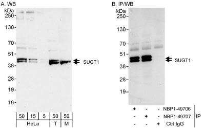 Western Blot: SUGT1 Antibody [NBP1-49707] - Samples: Whole cell lysate from HeLa (5, 15 and 50 ug for WB; 1 mg for IP, 20% of IP loaded), 293T (T; 50 ug) and mouse NIH3T3 (M; 50 ug) cells.  Antibodies: Affinity purified rabbit anti-SUGT1 antibody NBP1-49707 used for WB at 0.1 ug/ml (A) and 1 ug/ml (B) and used for IP at 3 ug/mg lysate.  SUGT1 was also immunoprecipitated by rabbit anti-SUGT1 antibody NBP1-49706, which recognizes an upstream epitope.  Detection: Chemiluminescence with exposure times of 30 seconds (A and B).
