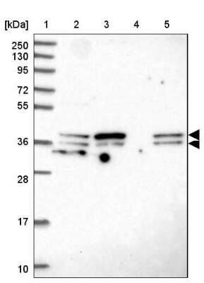 Western Blot SUGT1 Antibody - BSA Free
