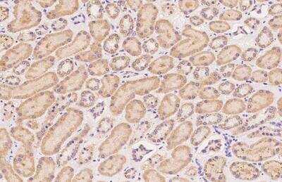 Immunohistochemistry-Paraffin: SUHW2 Antibody [NBP3-05966] - Staining of human SUHW2 in human kidney with rabbit polyclonal antibody at 1:1000 dilution.