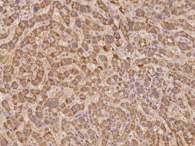 Immunohistochemistry-Paraffin: SUHW2 Antibody [NBP3-05966] - Staining of human SUHW2 in human liver with rabbit polyclonal antibody at 1:1000 dilution.