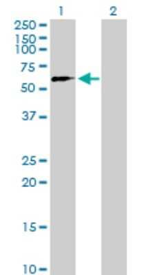 Western Blot: SUHW2 Antibody [H00140883-B01P] - Analysis of ZNF280B expression in transfected 293T cell line by ZNF280B polyclonal antibody.  Lane 1: SUHW2 transfected lysate(59.73 KDa). Lane 2: Non-transfected lysate.