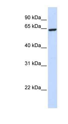 Western Blot SUHW2 Antibody - BSA Free