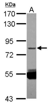 Western Blot: SUHW3 Antibody [NBP2-20530] - Sample (30 ug of whole cell lysate) A: NT2D1 7. 5% SDS PAGE gel, diluted at 1:1000.