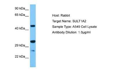 Western Blot: SULT1A2 Antibody [NBP2-83605] - Host: Rabbit. Target Name: SULT1A2. Sample Tissue: Human A549 Whole Cell lysates. Antibody Dilution: 1ug/ml